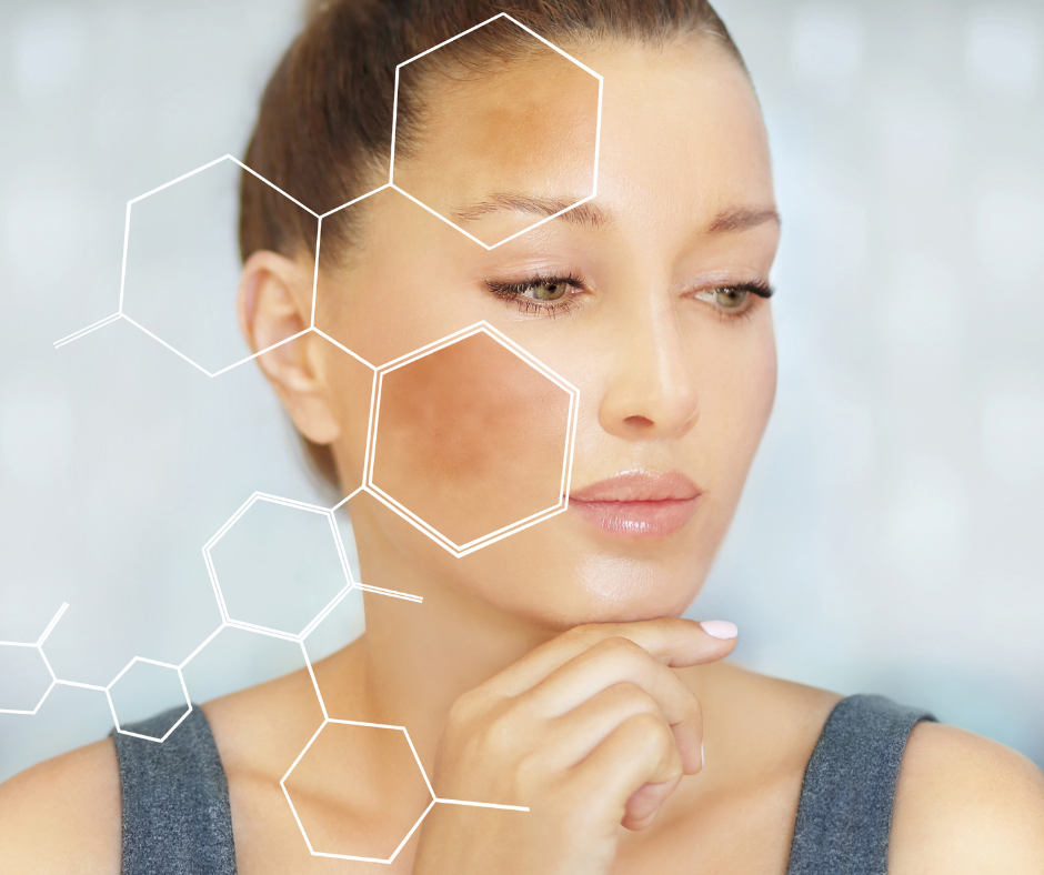 Hyperpigmentation on model face with hexagonal pattern on top